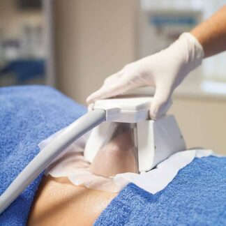 Cryolipolysis - Fat Freeze