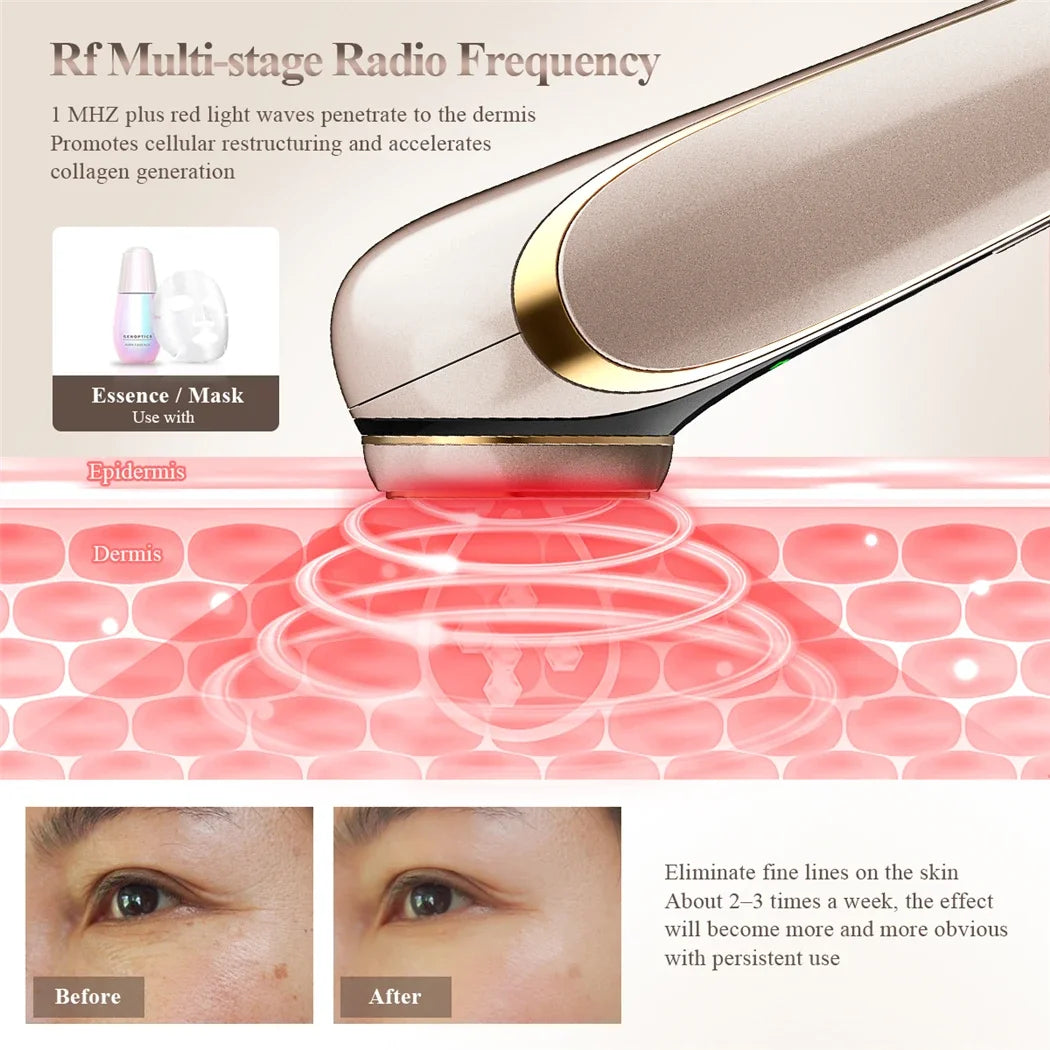 HIFU Face Skin Care EMS Facial Lifting Massager LED Photon Wrinkle Remover Vibration Anti-aging Device